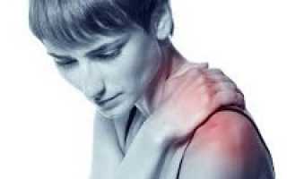 Плечелопаточный периартрит — причины, симптомы, диагностика и лечение