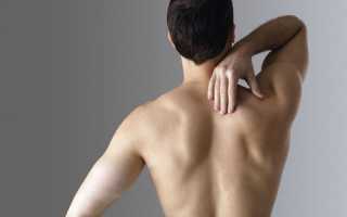 Защемление нерва в плече — Ортопед.info