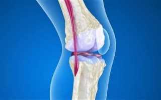 Остеопороз коленного сустава лечение — Суставы
