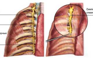 Невралгия симптомы грудного отдела с левой стороны