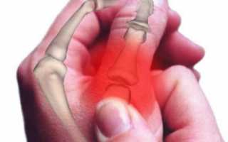 Чем лечить ревматоидный артрит кистей рук