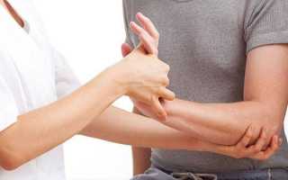 Гигрома кисти руки — причины, симптомы и лечение