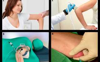 Боль в локтевом суставе с внутренней стороны руки: причины, диагностика и лечение