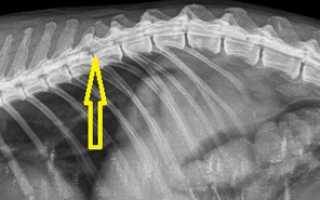 Рентген шейного отдела позвоночника с функциональными пробами