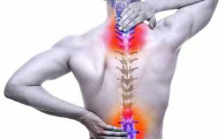 Боль в позвоночнике посередине спины отдает в живот