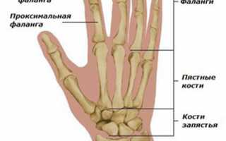 Боль в суставах пальцев рук: причины, лечение мазью. Как и чем снять боль при сгибании больших пальцев рук