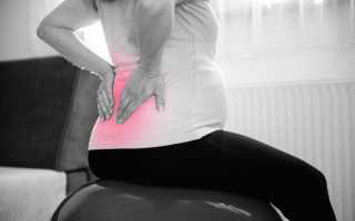 Мази от боли в спине при беременности